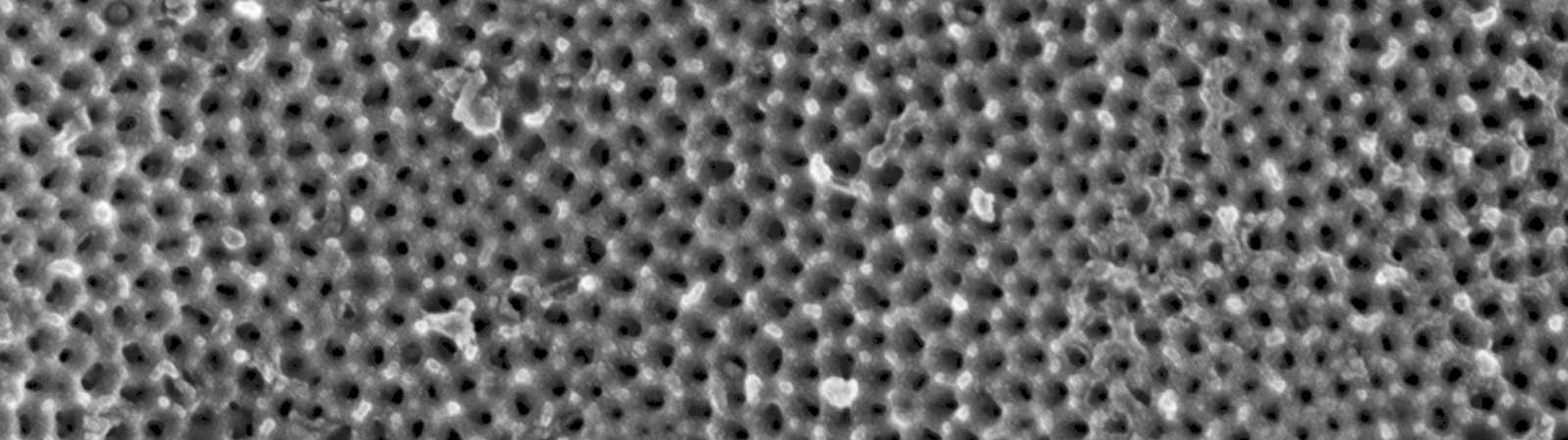 Eloxalporen Elektronenrastermikroskop